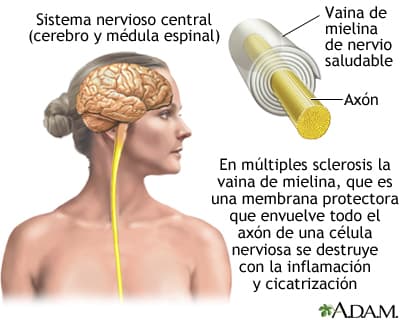 Representación gráfica de la mielina